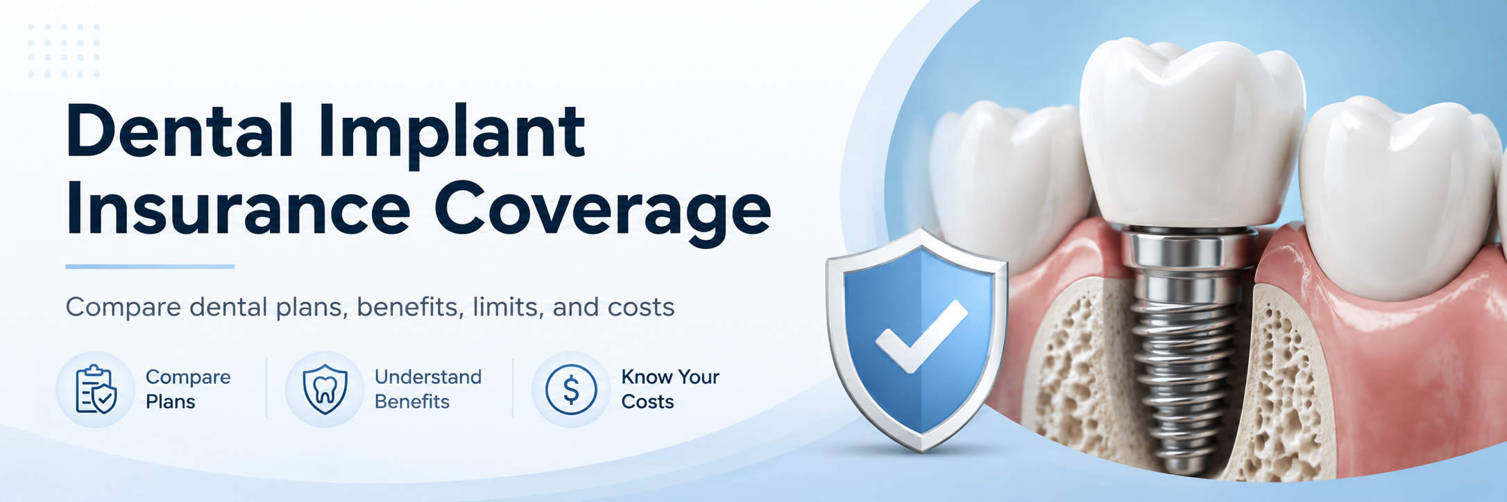 Dental Implant Coverage